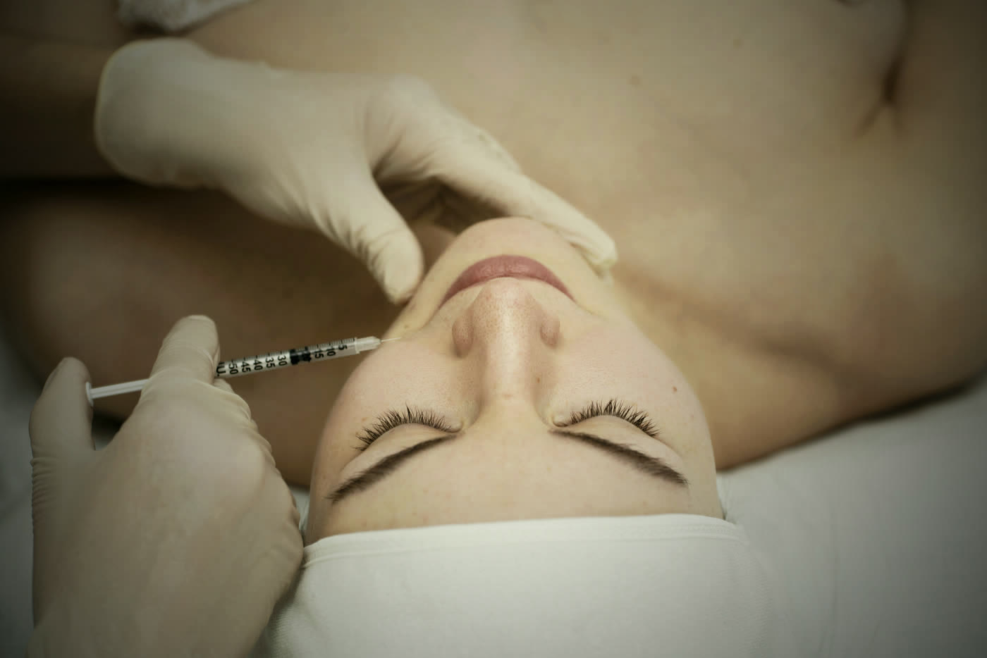 Dermal Fillers, the Natural Way