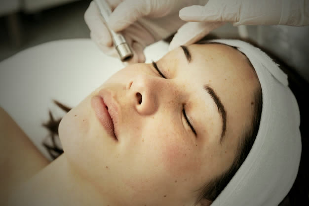 Microneedling + PRP