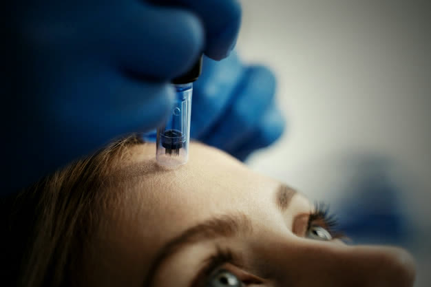 Microneedling & PRP